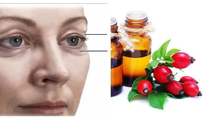 No es necesario un corrector para cubrir las ojeras: Usa aceite rosa de mosquea