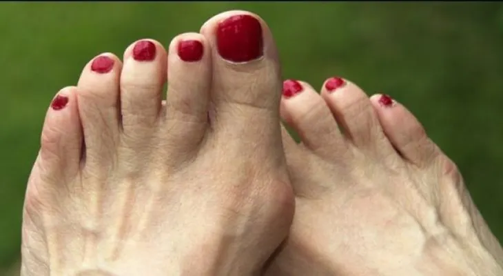 6 intervenciones por salud que mejoran tu estética
