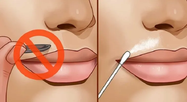 Remedio para el vello no deseado. ¡Suavemente y sin dolor, se elimina todo!