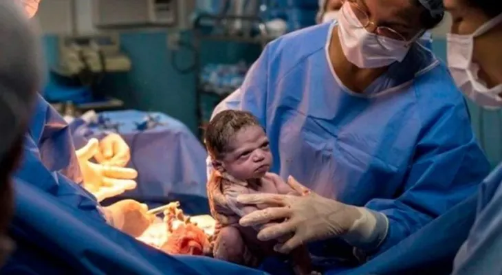 El increíble comportamiento de una bebé, que no lloró al nacer, y puso una cara de enojo 