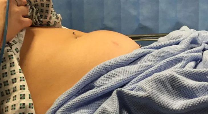 Ella casi muere por un tampón?