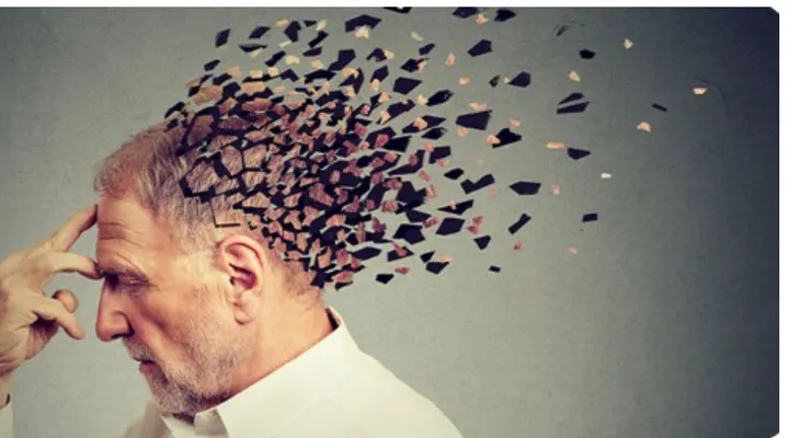 Estudio vincula salud bucal con Alzheimer