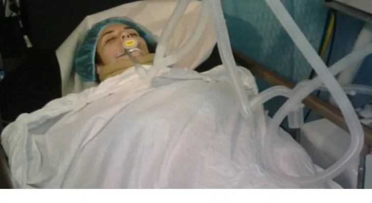 Un dominicano muerto y una venezolana en estado crítico por accidente en Boca Chica