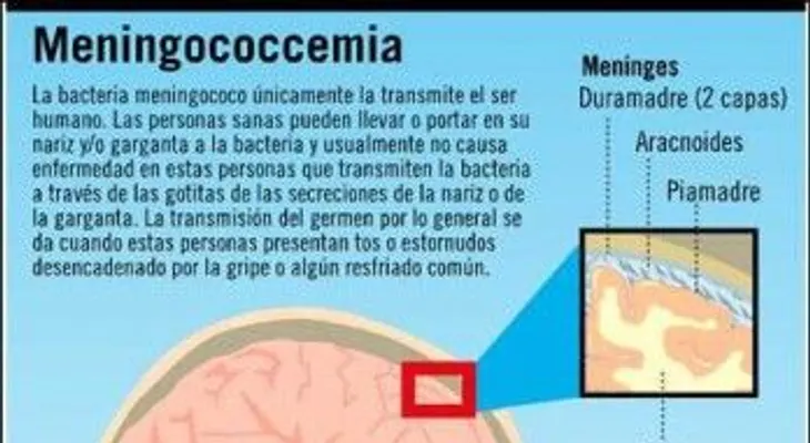 Muere menor por meningococemia; hay otros tres infectados 
