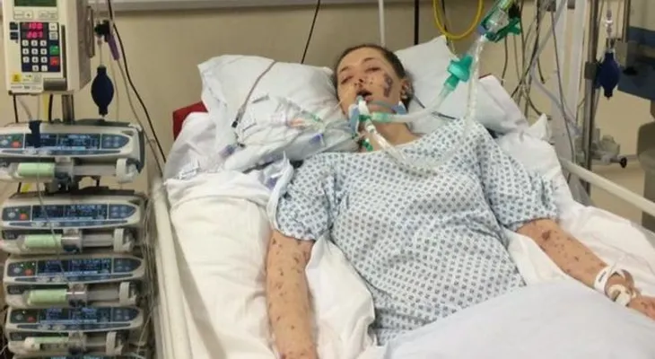 FOTOS MUY FUERTES: Una joven muestra crudas imágenes para crear conciencia sobre su enfermedad