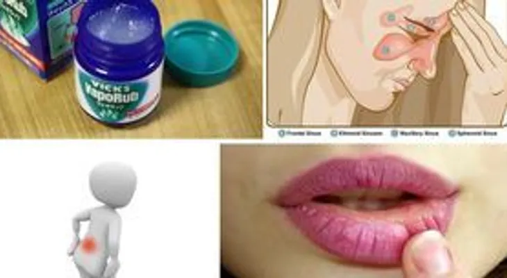 Dile bye bye a las estrias y hongos de las uñas con el VICK VAPORUB: 13 usos increíbles