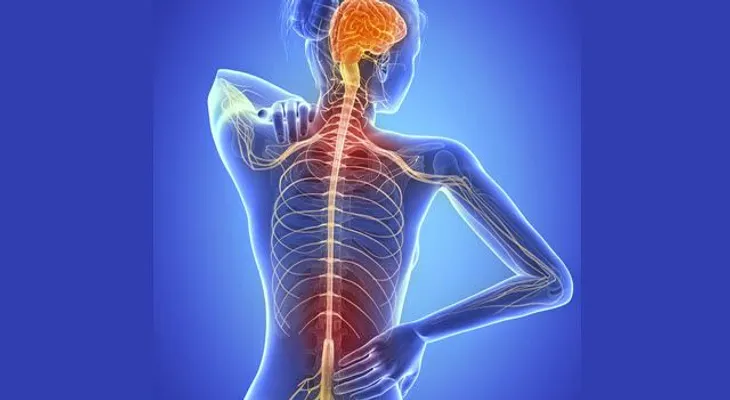 México tiene disponible tratamiento para esclerosis múltiple