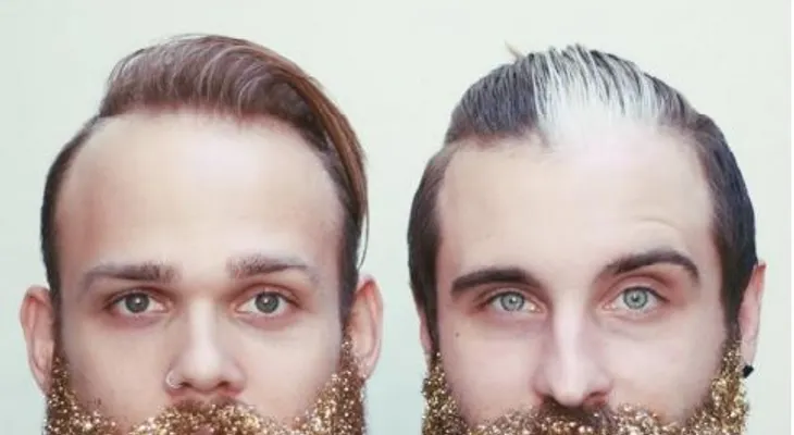La gente ahora cubre sus barbas con brillos para Navidad