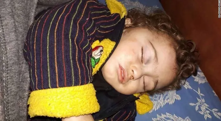 Nadie sabe quién es este niño sirio inconsciente que sobrevivió a los bombardeos