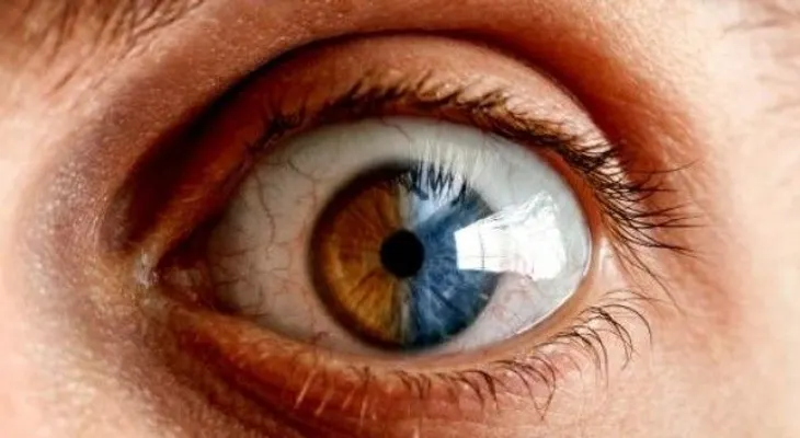 Los cambios de color en tus ojos revelan posibles enfermedades