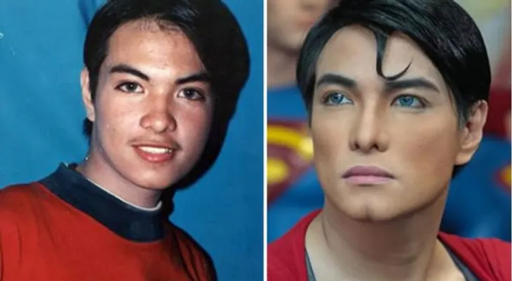 Joven se hace 19 cirugías para parecerse a Superman
