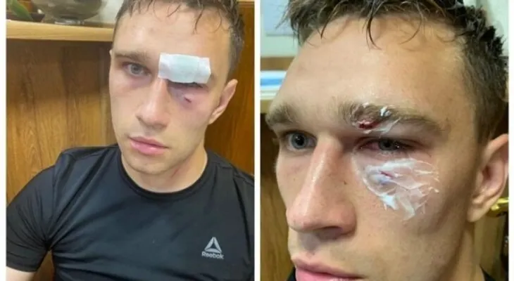 El salvaje ataque de Roman Shirokov a un árbitro en pleno partido