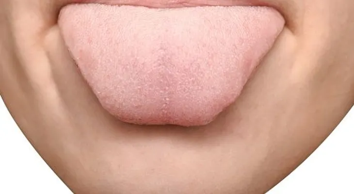 La lengua es un mapa de nuestro estado de salud