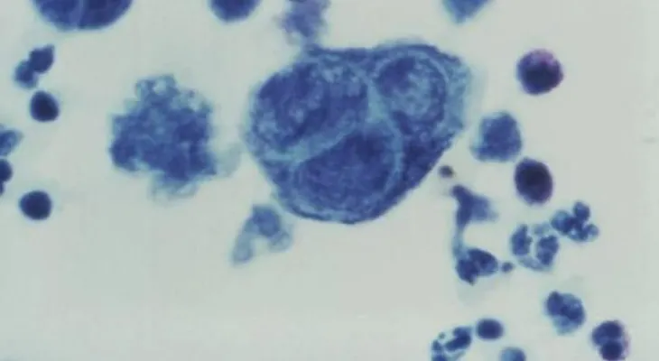 Más cerca de una vacuna contra el herpes genital