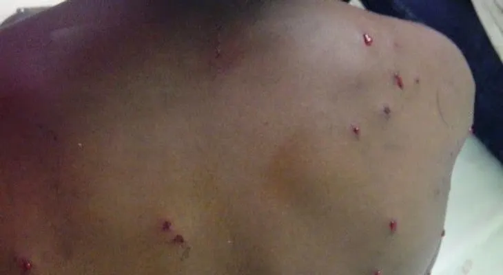 Juez libera agresor de estudiante fue impactada con perdigones