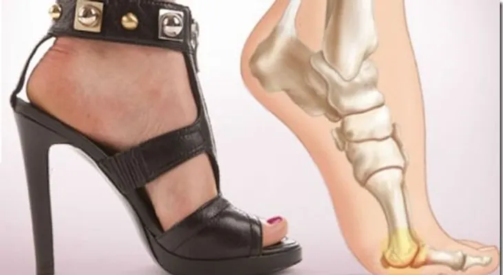 Truco para usar tacones altos sin sentir dolor en los pies !