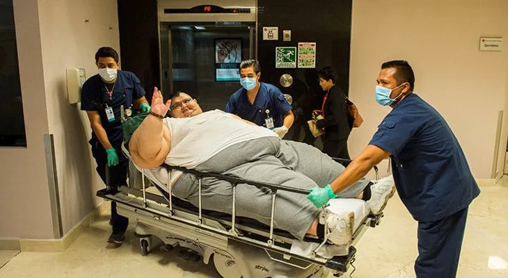 Intervienen con éxito el hombre más obeso del mundo