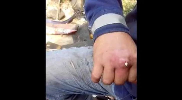 Le rogaron que fuera al médico y no quiso ir, y reventó esto a sangre fría (VIDEO)