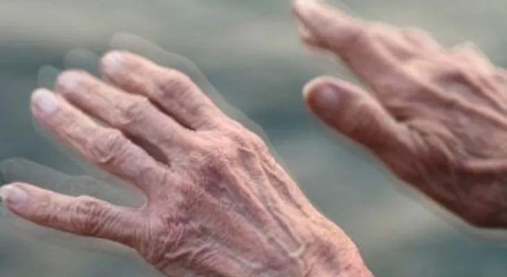 Universidad de Japón realiza primer trasplante de células madre para tratar Parkinson
