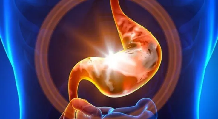 Estas son las 10 posibles causas que generan gastritis