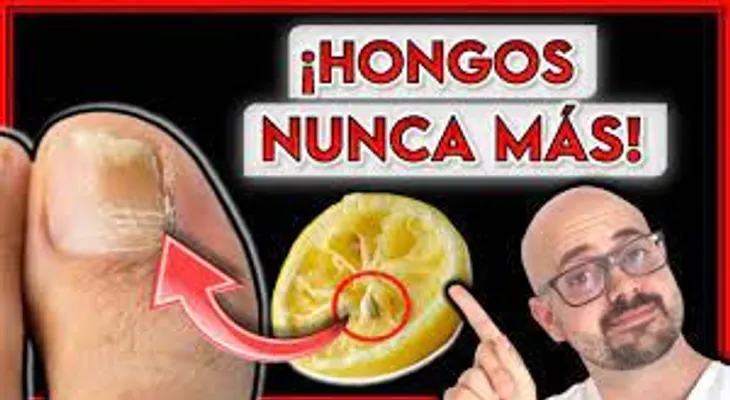 Remedios efectivos para hongos de los pies