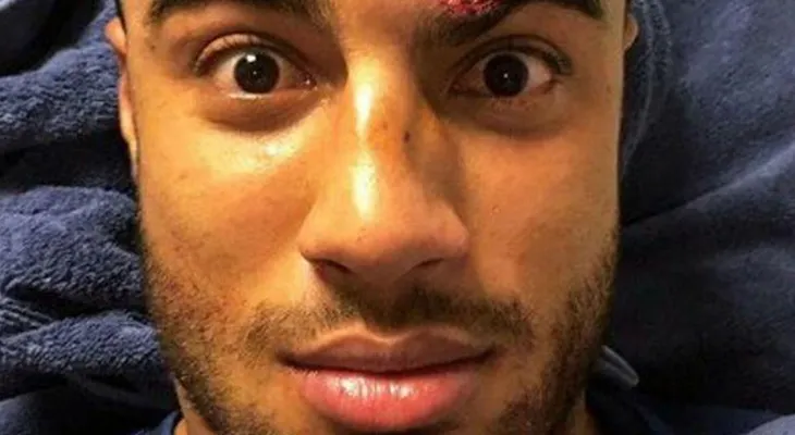 La escalofriante herida de un futbolista del Barça que recibió 12 puntos de sutura