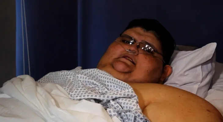 "Quiero estar bien y salir adelante": la nueva vida del hombre más obeso del mundo