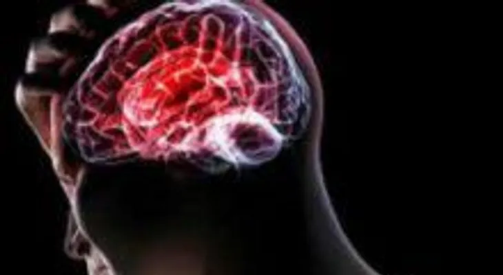 ATENCIÓN! puede estar sufriendo de un derrame cerebral sin saberlo 