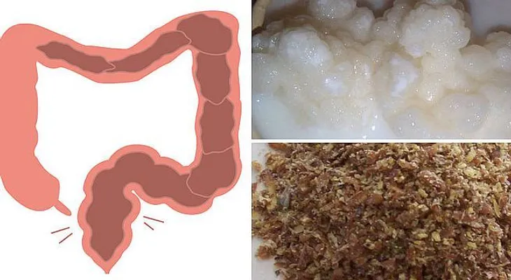 Impactante: podrías tener 33 libras de tóxinas en tu cuerpo!? Eliminalo !!? 
