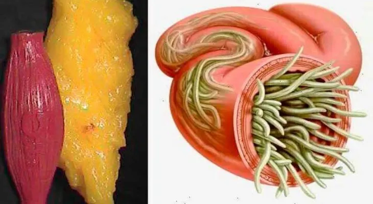 2 ingredientes para vaciar los depósitos de grasa y parásitos del cuerpo como si nada