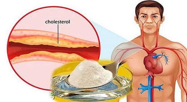 La medicina más efectiva contra el colesterol y la presión arterial alta 100% natural