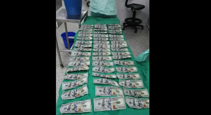 Mujer se tragó 7.000 dólares en billetes de 100 por una pelea familiar