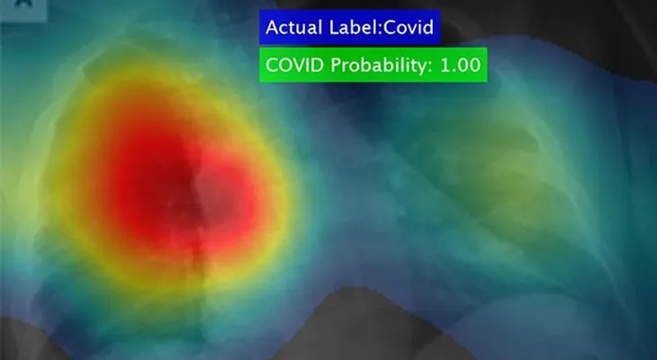 Un científico crea poderoso software que detecta el coronavirus en segundos y con un 98% de precisión 