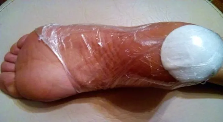 10 días serán suficientes con este remedio para quitar por completo los talones agrietados 