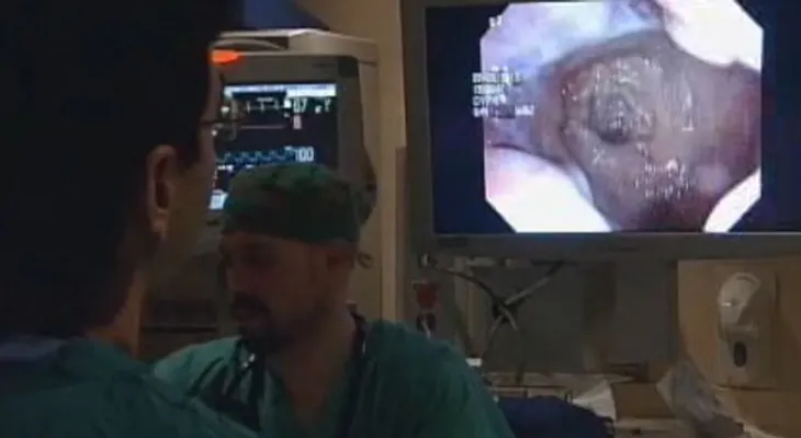 Hallan relación entre la grasa y el cáncer