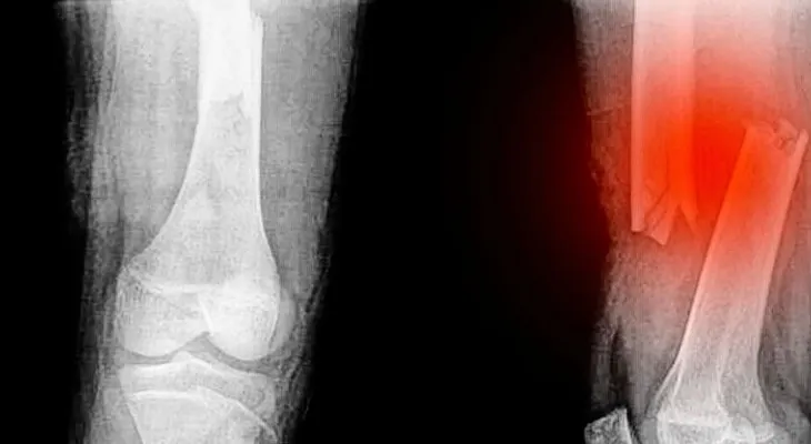 Científicos revelan qué sexo padece más el dolor 
