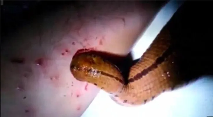 Alimenta a sanguijuela con su sangre (Video)