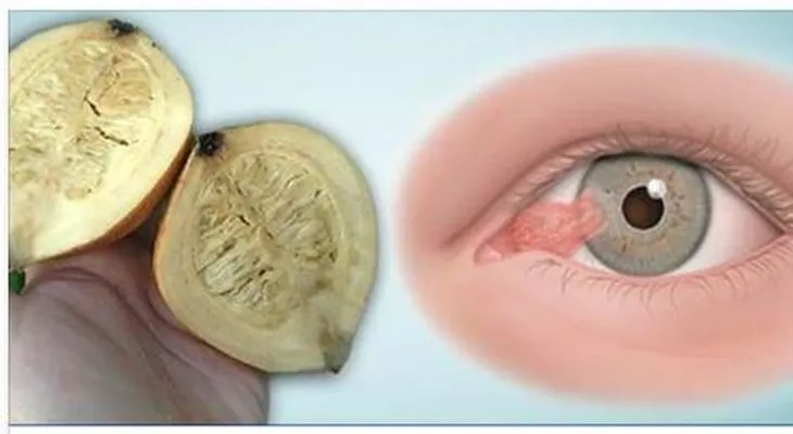 Receta para curar la visión definitivamente. Bébelo al irte a dormir y observa como en la mañana tendrás 50% más de vista