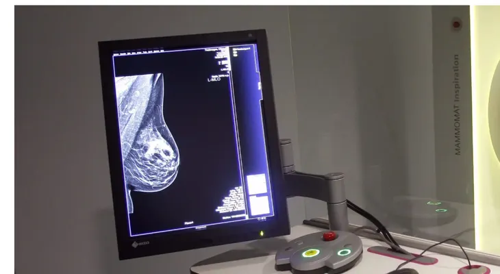 Día Mundial Cáncer de Mama: prevención y detección