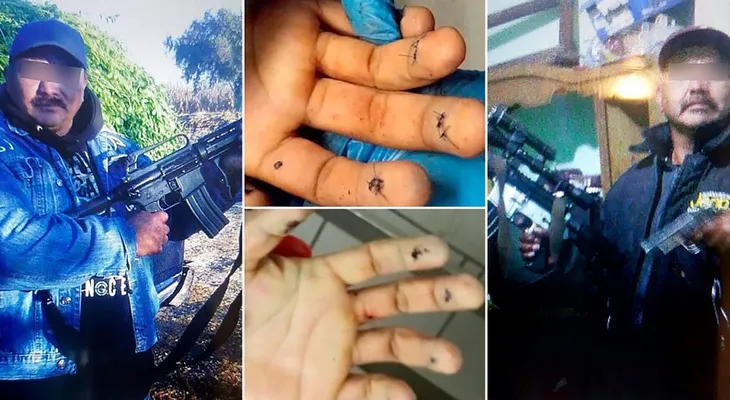 Asesinan capo mexicano "El Kalimba, mientras se sometía a una cirugía estética 