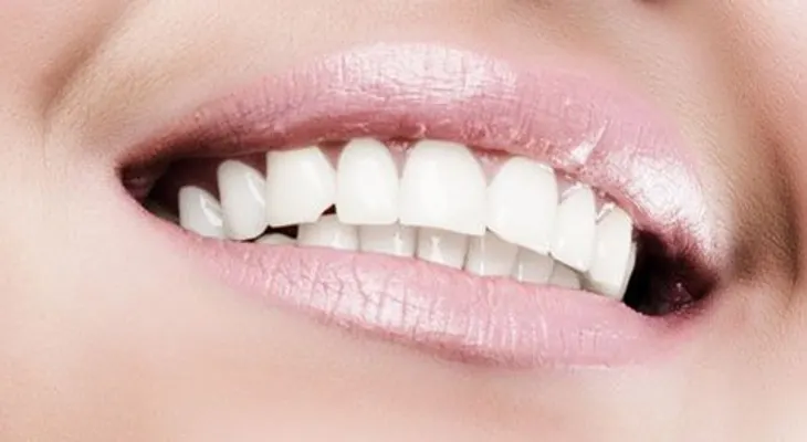 Remedios caseros efectivos para blanquear los dientes; No 1, 2, 3 y 4