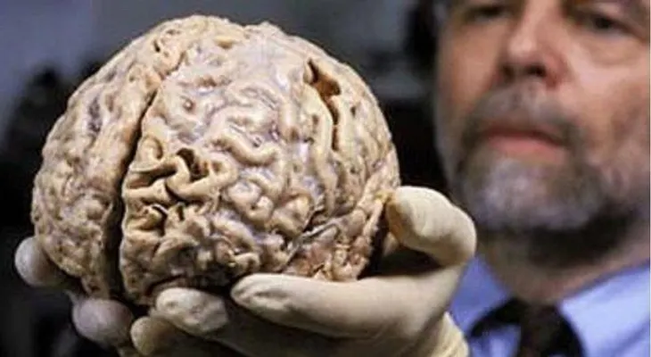  El fenómeno del déjà vu es un "truco del cerebro" y no algo sobrenatural 