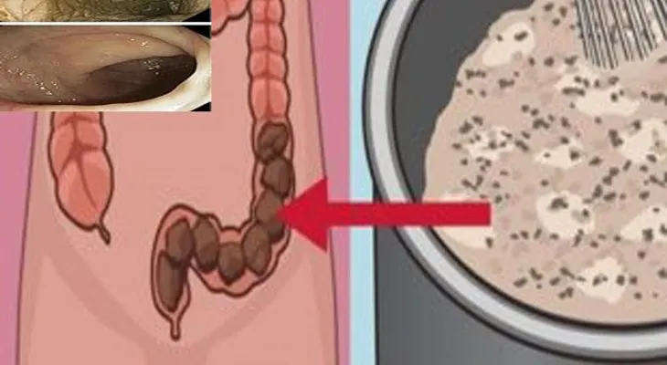 Limpiar el colon y pierde 10 kilos en tan sólo 3 semanas con este poderoso remedio natural!