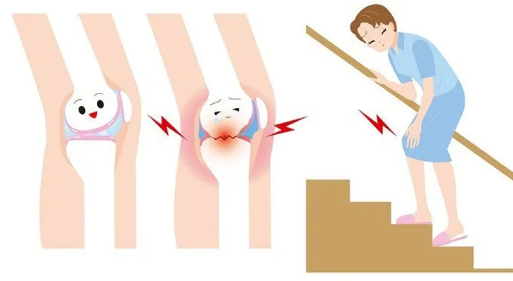 Fortalecer los huesos y tratar el dolor de articulaciones con bebida de 4 ingredientes