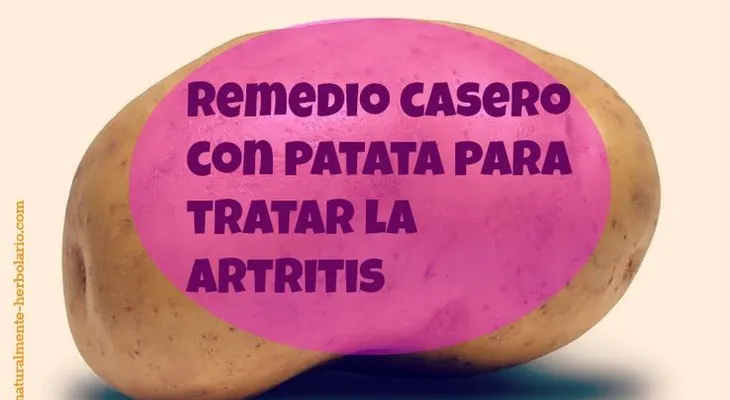 37 remedios para la artrosis y recomendaciones