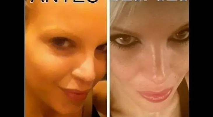 Rápido y eficaz, adelgazar el rostro o la cara en 15 minutos (VIDEO)