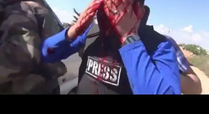 Periodista herido de gravedad mientras grababa reportaje (advertencia: VIDEO +18)