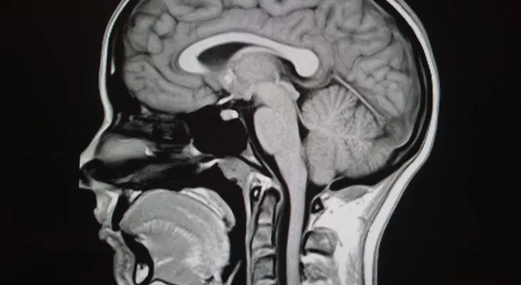 La ciencia de las ideologías en el cerebro humano