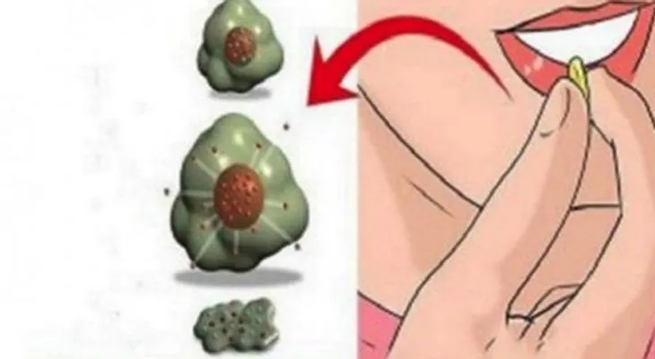 Alimentos que matan el cáncer; es hora de empezar a comerlos