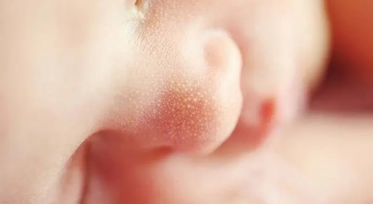 Estudios revelan antibióticos y cesáreas afectarían flora intestinal de bebés